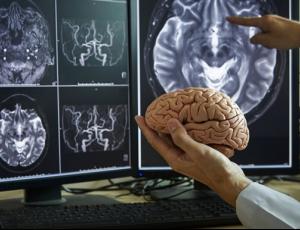 Учёные объяснили механизм потери памяти при болезни Альцгеймера