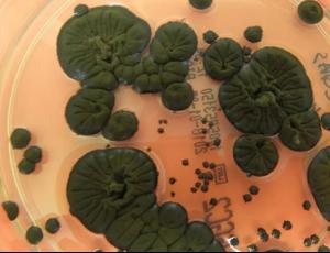 NASA рассматривает чернобыльские грибы как защиту от радиации в космосе