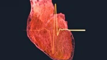 Ученые назвали возраст, при котором риск инфаркта у мужчин резко возрастает