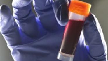 Учёные обнаружили связь между группой крови и риском диабета 2 типа