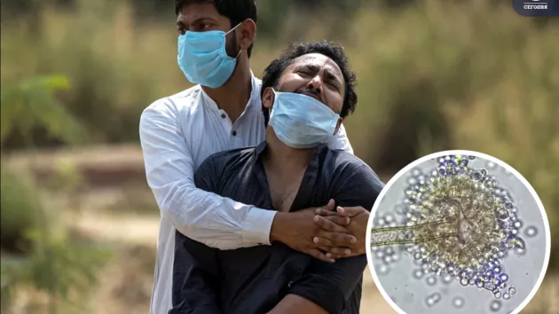 Начало новой эпидемии? В Индии обнаружили первый случай "зеленой плесени"
